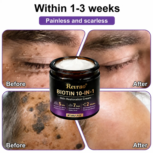 Made and Shipped from USA✨Revrao® Biotin 10-in-1 Skin Restoration Cream🍀