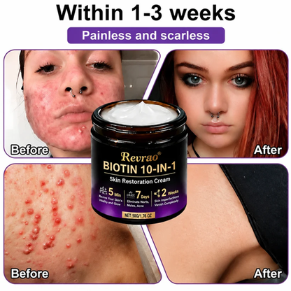 Made and Shipped from USA✨Revrao® Biotin 10-in-1 Skin Restoration Cream🍀