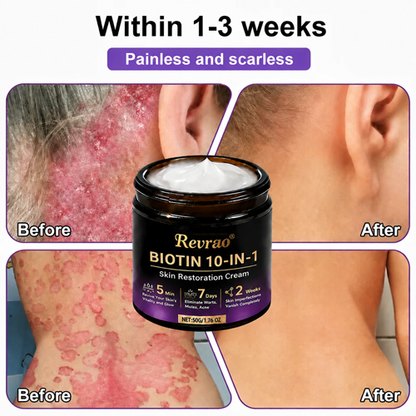 Made and Shipped from USA✨Revrao® Biotin 10-in-1 Skin Restoration Cream🍀