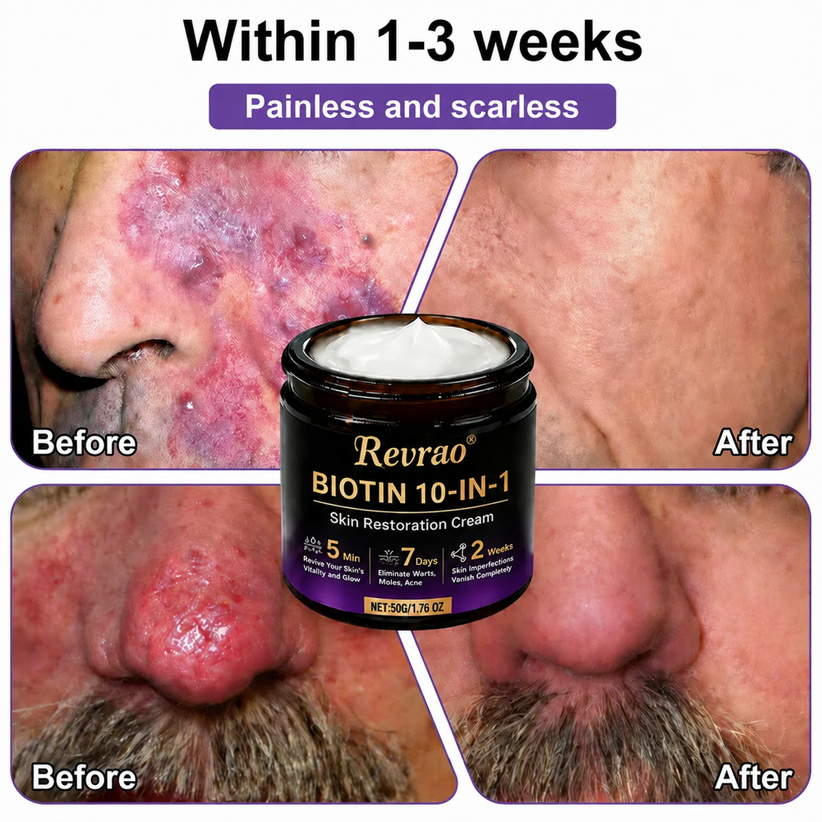 Made and Shipped from USA✨Revrao® Biotin 10-in-1 Skin Restoration Cream🍀