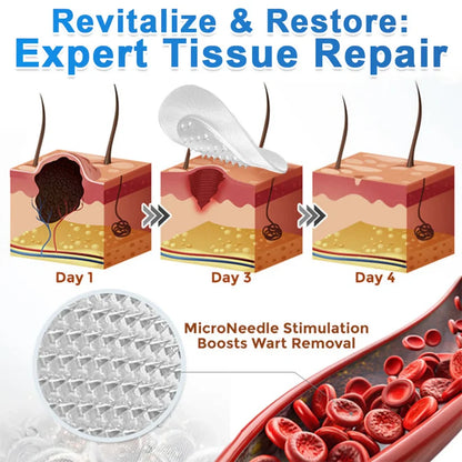 Flawless skin in 5 days – painless removal of skin tags, moles, and warts.